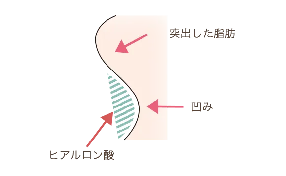 横から見る目の下の凹み