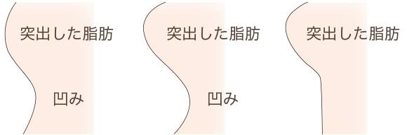 二重まぶた 目もとの整形施術一覧 美容整形 美容外科なら水の森美容外科 公式 総合サイト