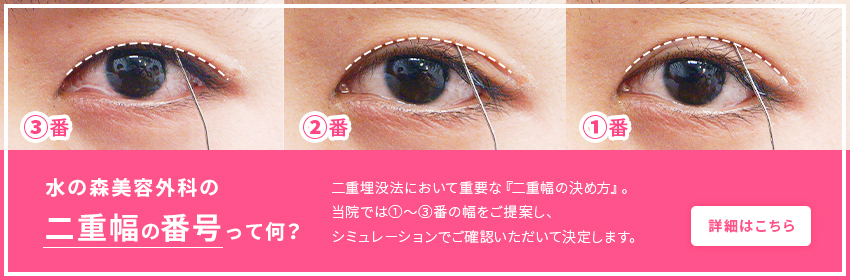 埋没法による二重まぶた整形 目 二重整形 美容整形なら水の森美容外科 公式 総合サイト