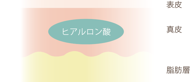 ヒアルロン酸でボリューム形成