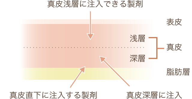 失敗例