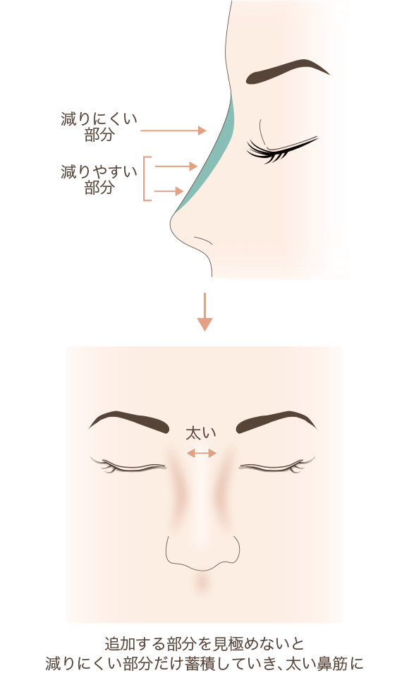 どのように高くするのがキレイに見えるのか解説図