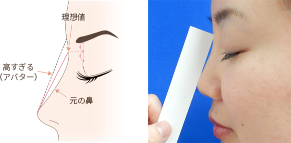 水の森美容クリニックの診察ポイント【理想値】