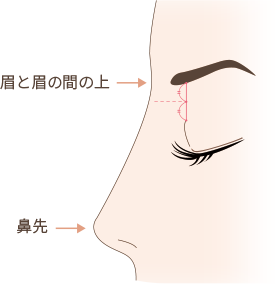 不自然な高い鼻（アバター鼻）