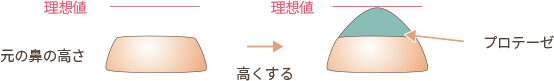 隆鼻術で高くして鼻筋を通すイメージ