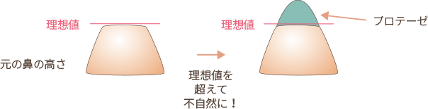 理想値を考えず、隆鼻術を行ってしまったパターン