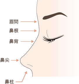 隆鼻術説明図
