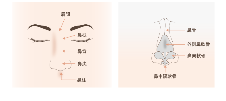 鼻骨骨切りの解説図