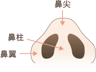 小鼻縮小の解説図