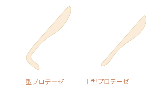 L型・I型プロテーゼの違い説明図