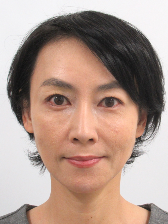 （若返り輪郭形成）施術後