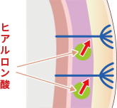 ボリューム形成