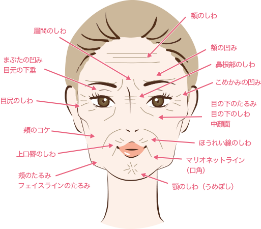 お顔に現れる様々な老化現象の図