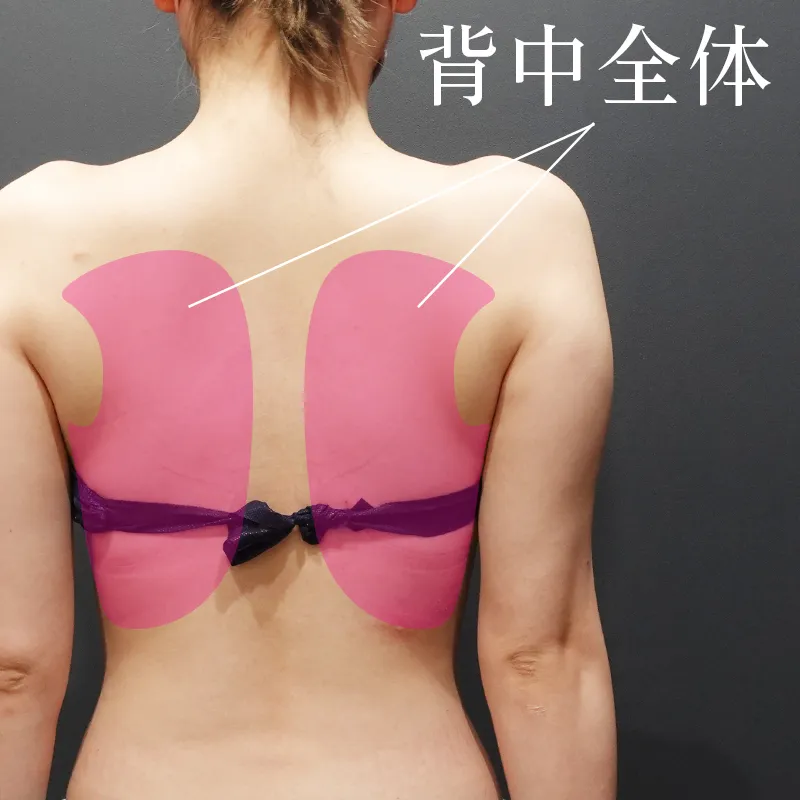 背中全体