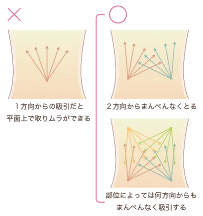 クリスクロス法