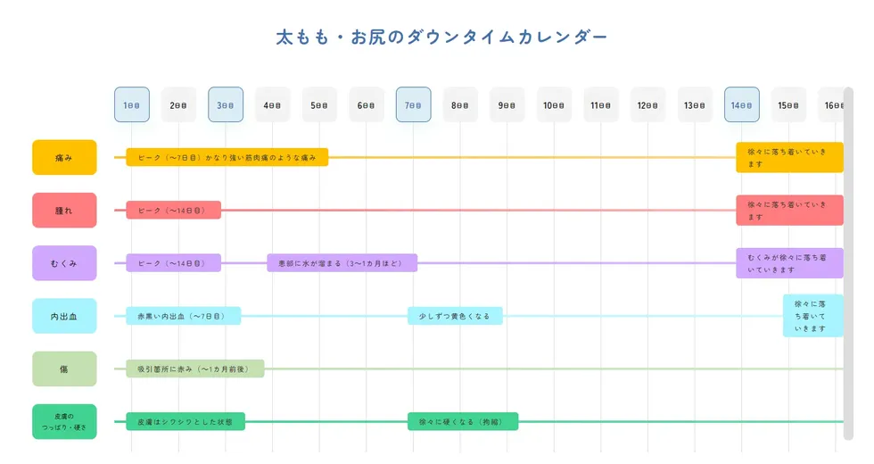 ダウンタイムカレンダー