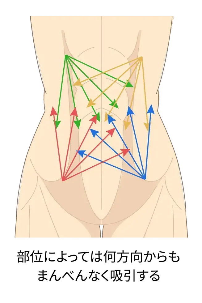 下腹部の吸引方法