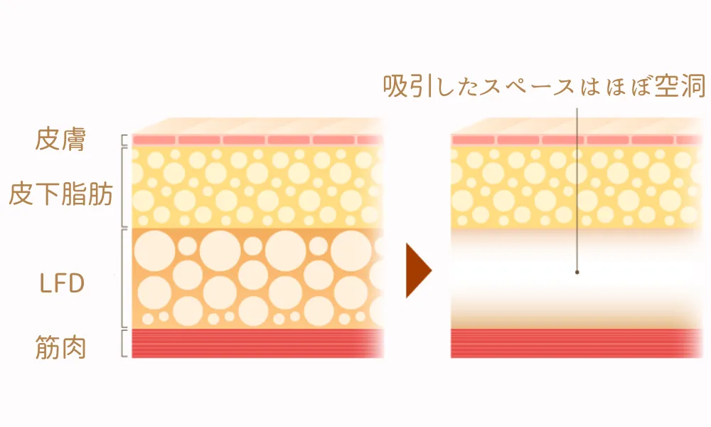 空洞ができる様子