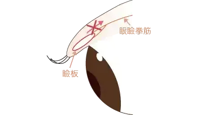 眼瞼下垂の原因