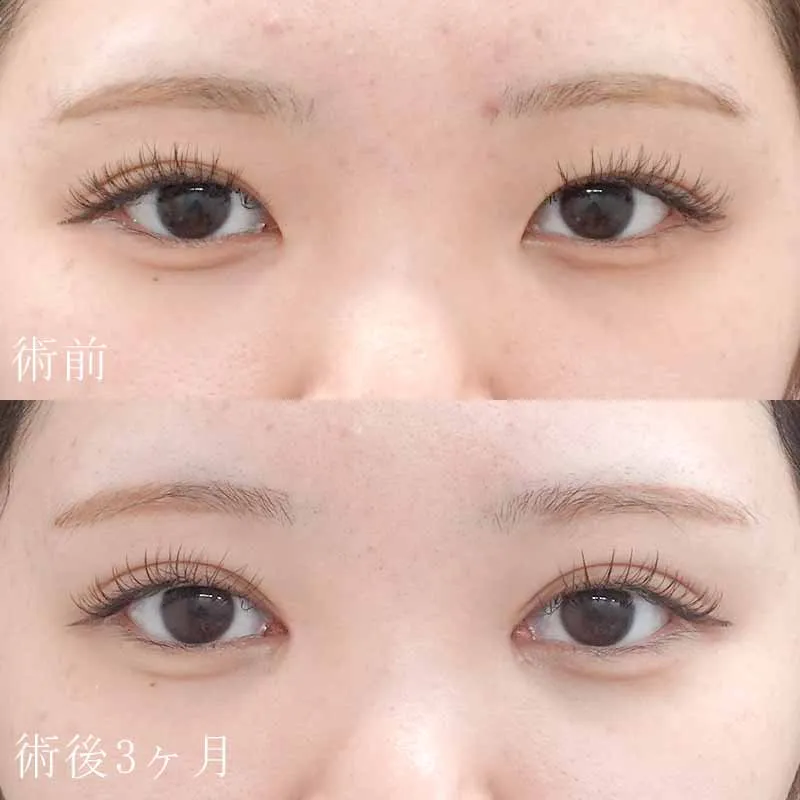 古村症例写真01