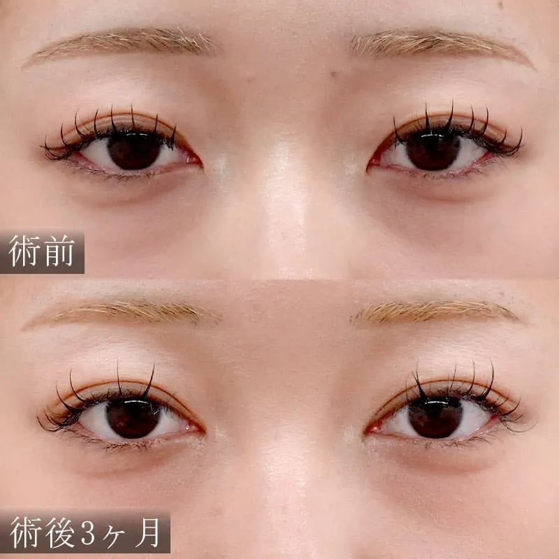 小野症例写真