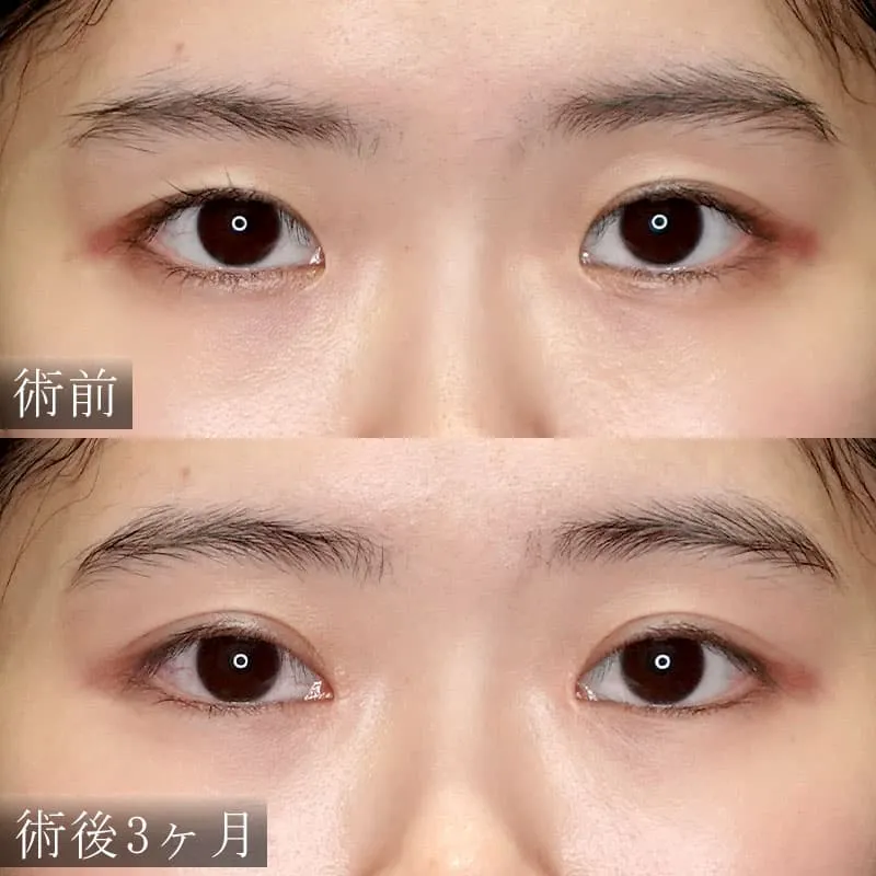 長田症例写真02