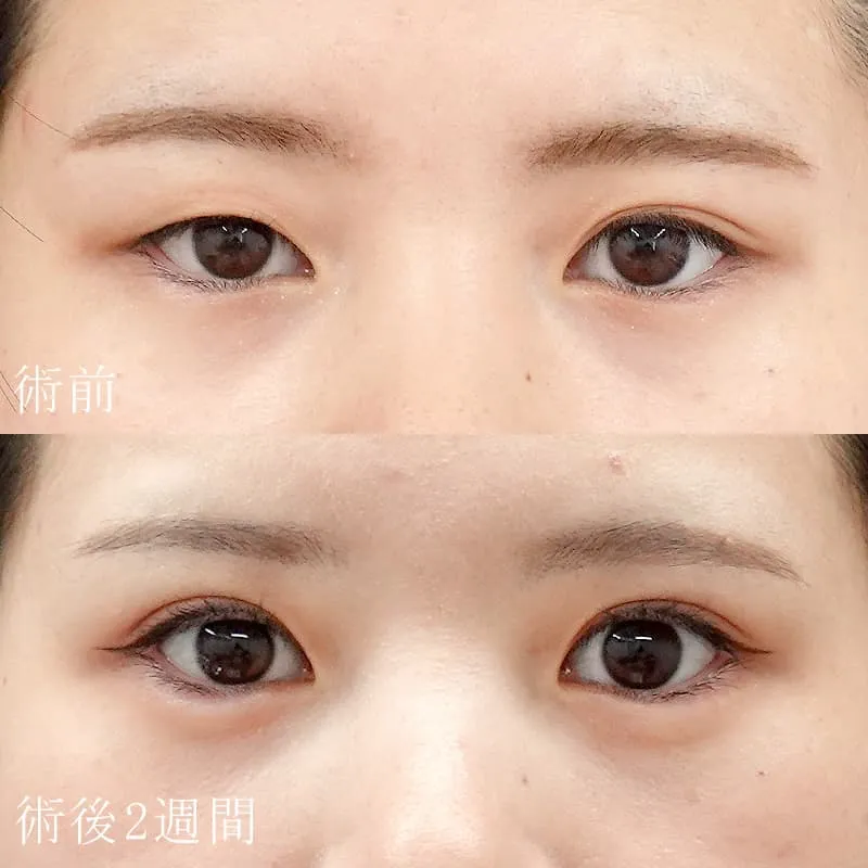 太田症例写真02
