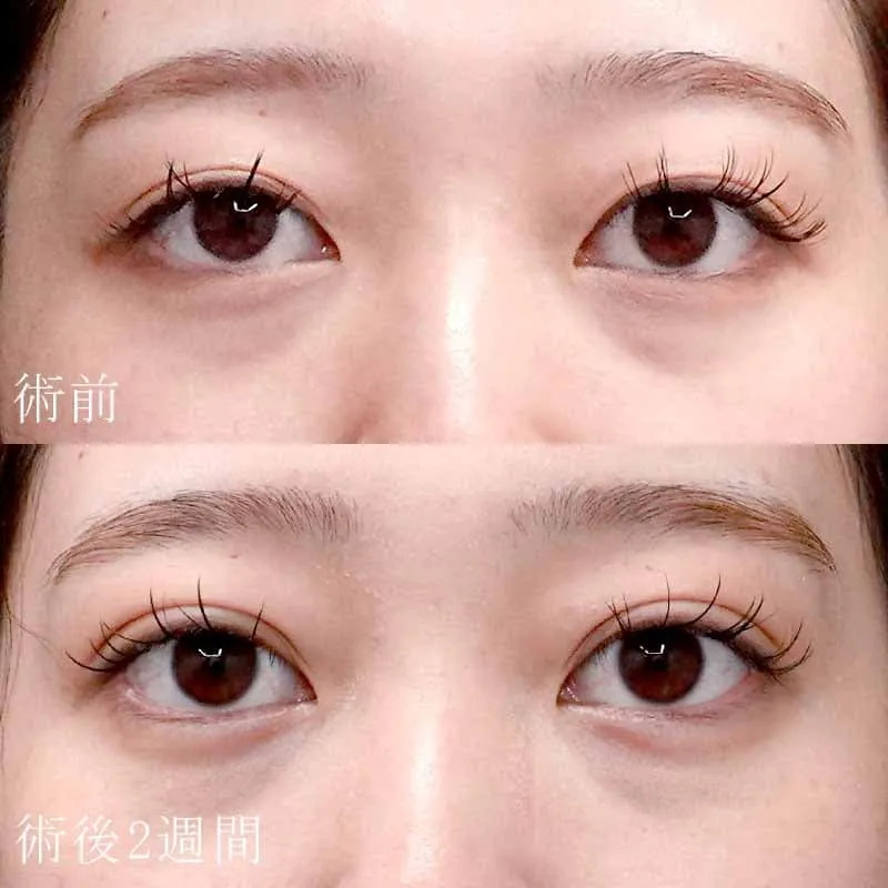 常盤症例写真