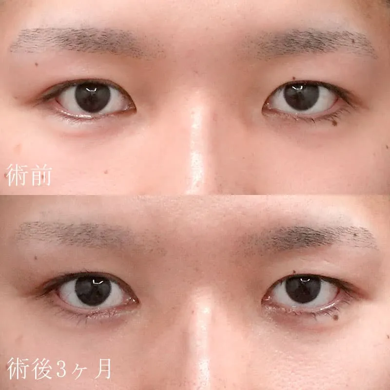 症例写真(5)