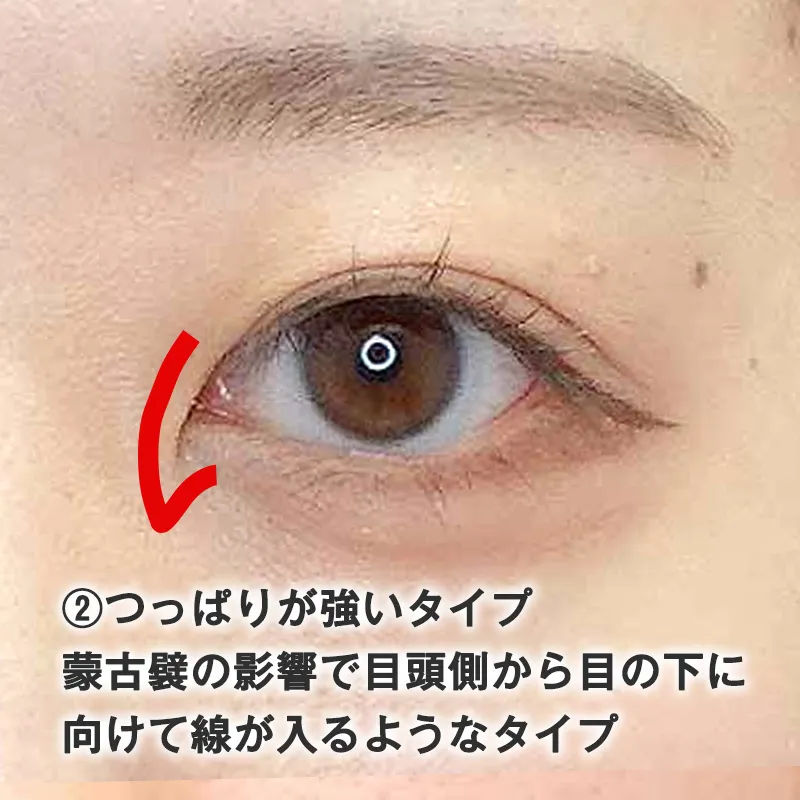 つっぱりが強いタイプ
