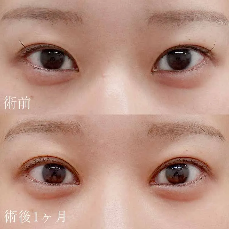 症例写真(6)