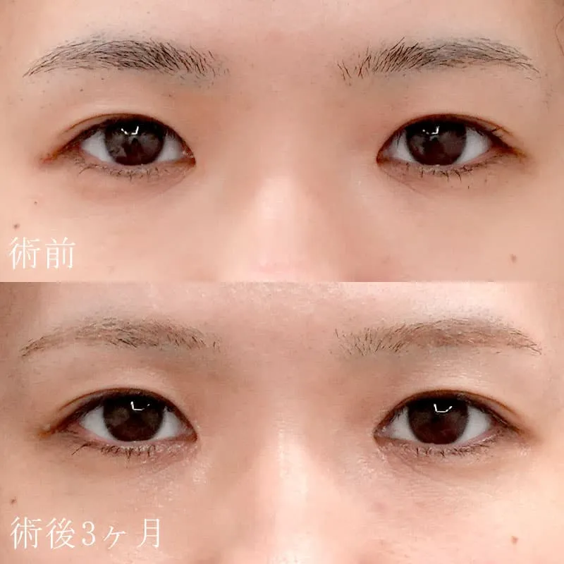 症例写真(2)