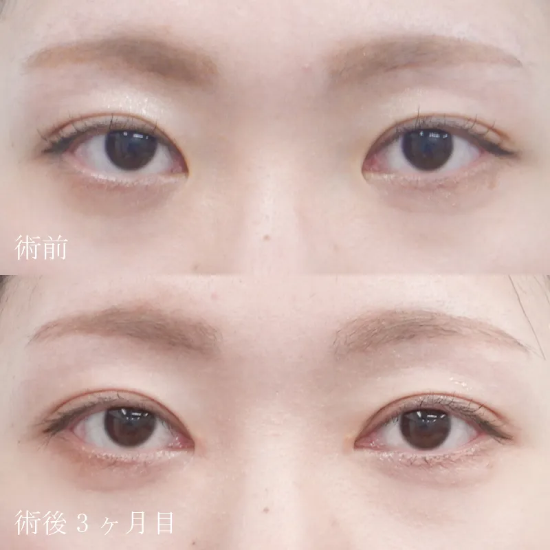症例写真(3)