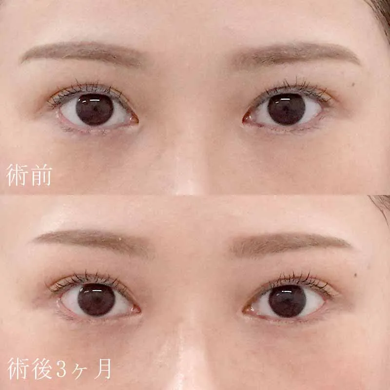 症例写真(2)