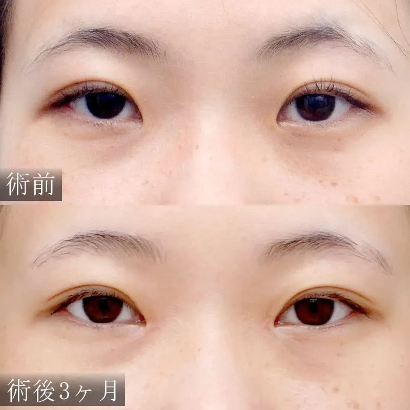 症例写真(3)
