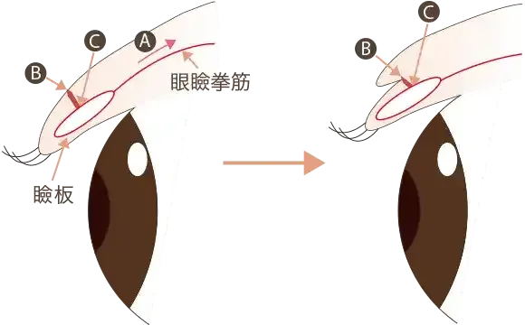 後戻りを防ぐ工夫
