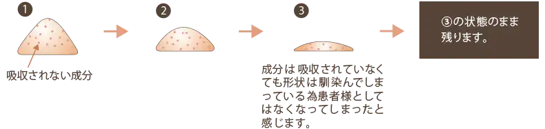 非吸収製剤に注意する