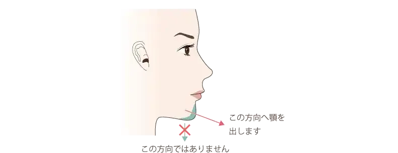 ヒアルロン酸注入で顎を出す方向