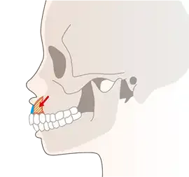 前歯の図