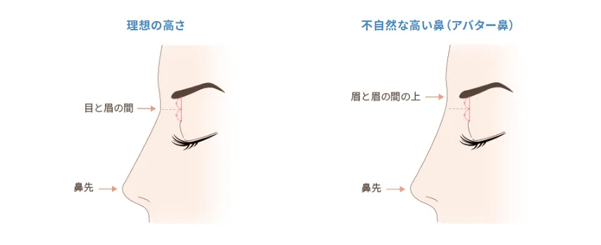 理想値の高さと不自然な高さの違い