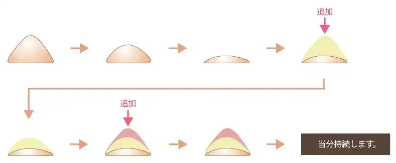 ③ヒアルロン酸の再注入について