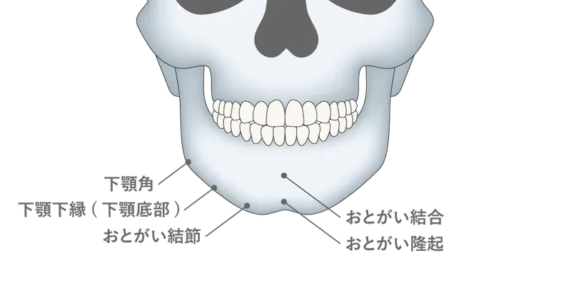 おとがい形成術