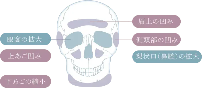 顔の骨格の変化