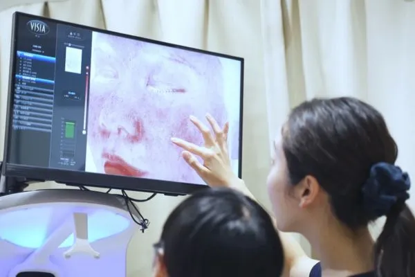 肌診断機 「VISIA」を導入