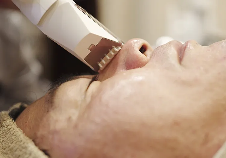 VISIAの肌診断の様子