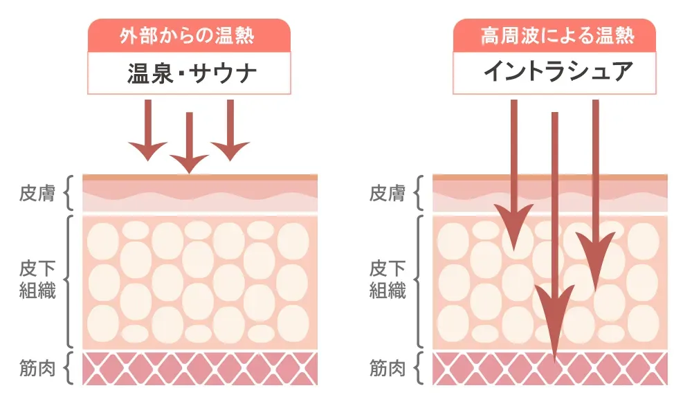 温熱効果の比較