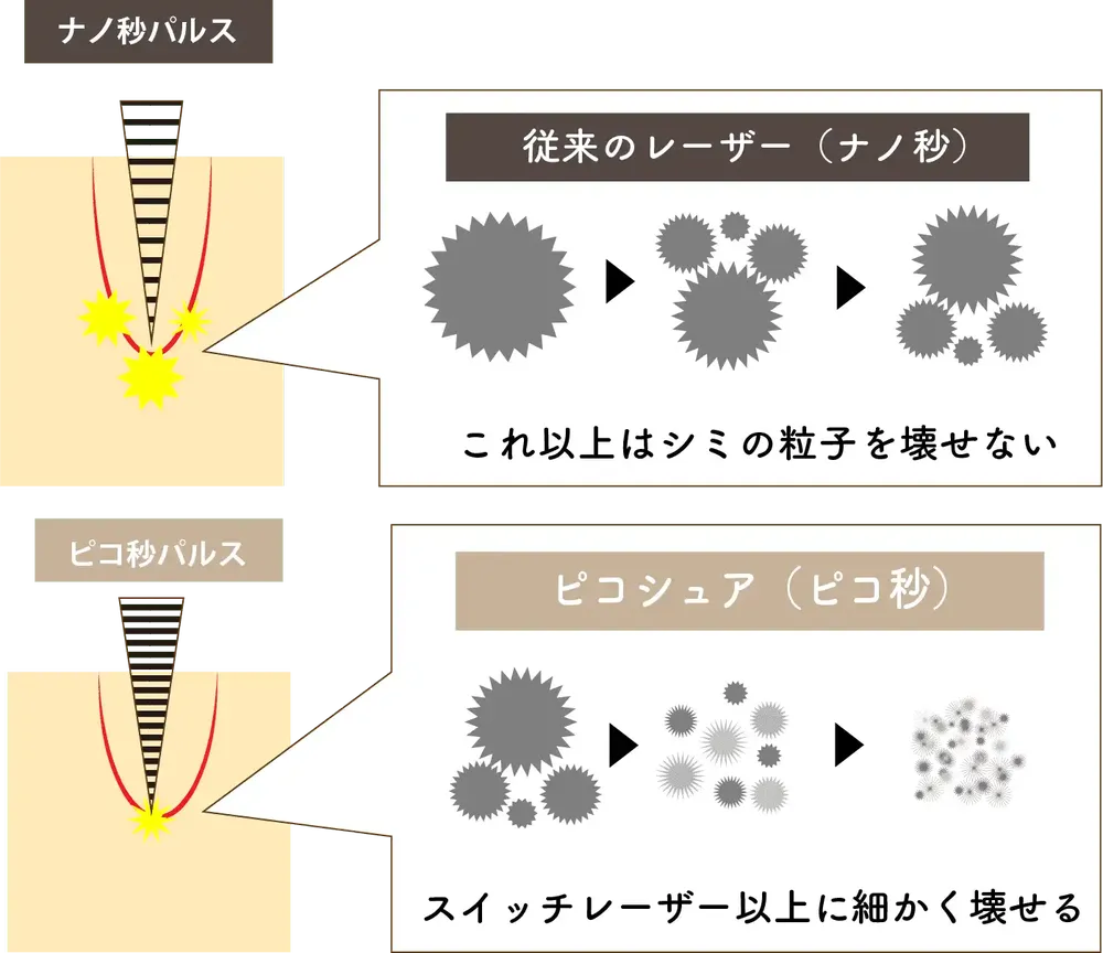 少ない施術回数で確かな効果