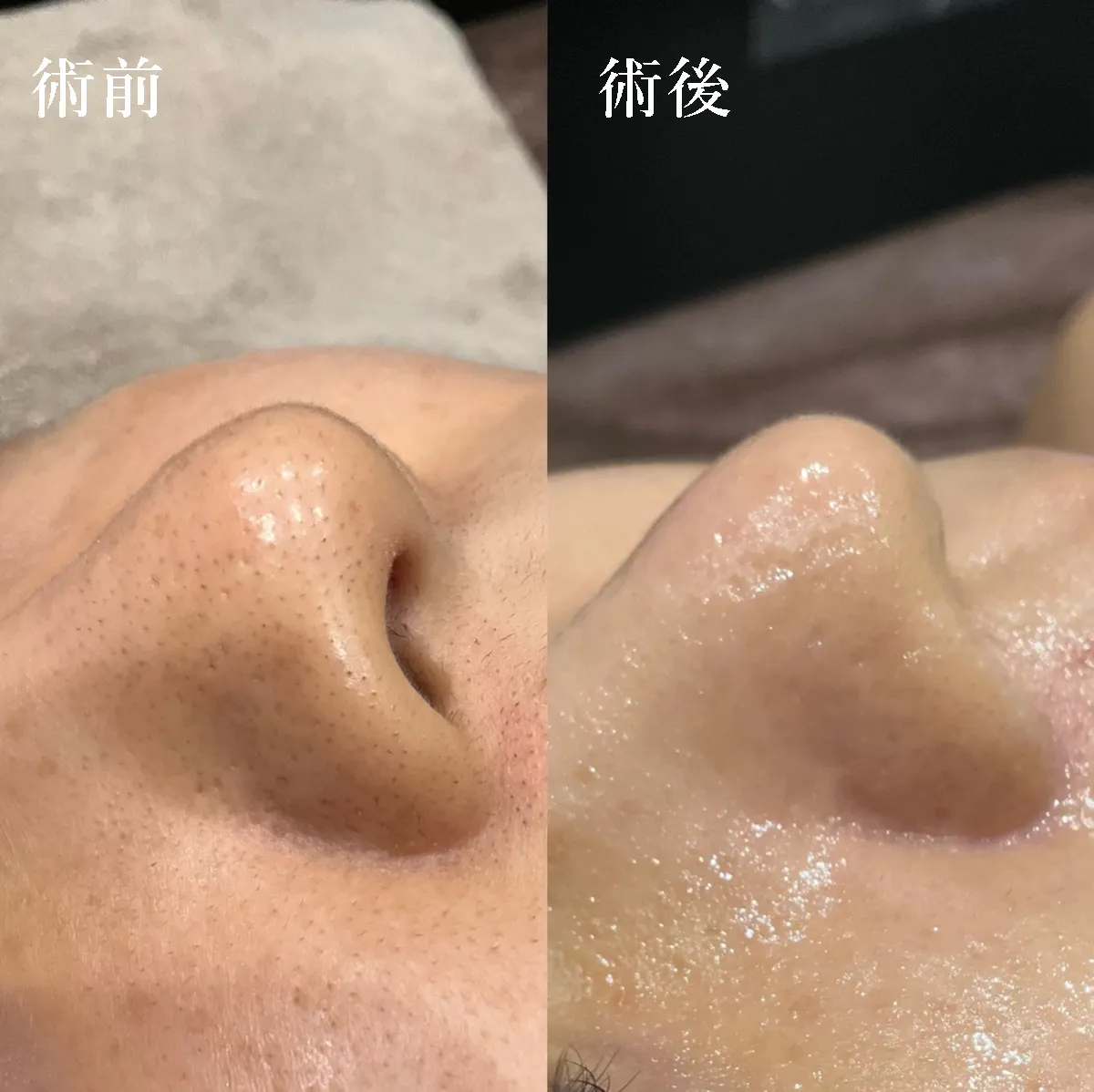 艶玉ブースターの症例写真