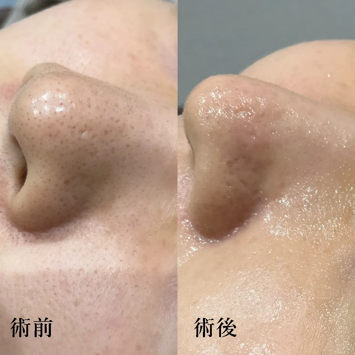 艶玉ブースターの症例写真
