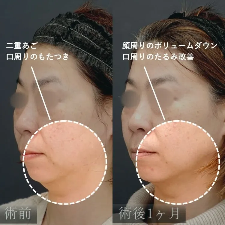 症例